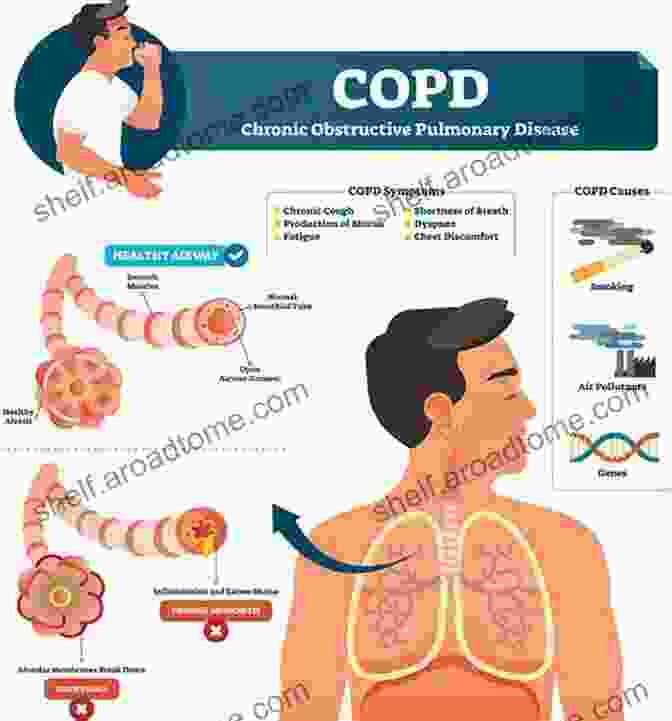 Chronic Obstructive Pulmonary Disease (COPD) Is A Progressive Lung Disease That Makes It Difficult To Breathe. Chronic Obstructive Pulmonary Disease (The Facts)