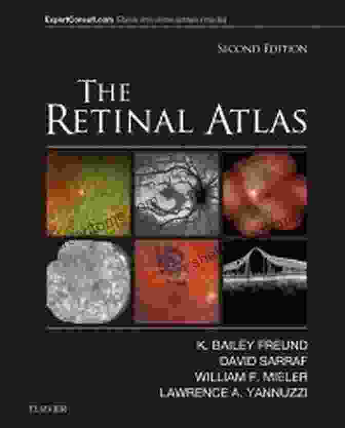 Cover Of 'The Retinal Atlas' By Harriet Earle The Retinal Atlas E Harriet E H Earle