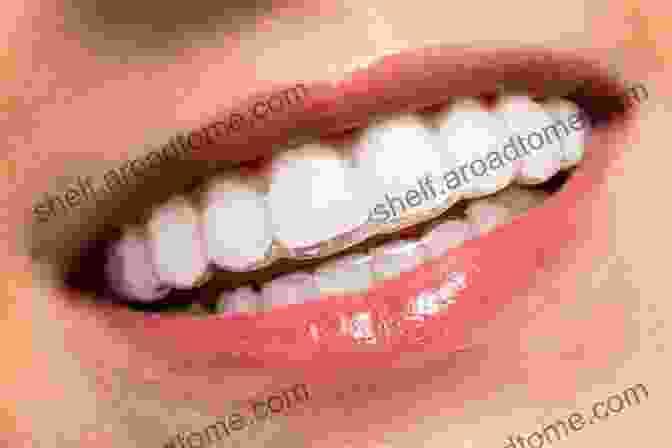 Invisalign Clear Aligners Brace Yourself: The Ultimate Guide To Braces Invisalign And A Beautful Smile