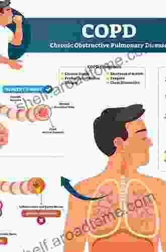 Chronic Obstructive Pulmonary Disease (The Facts)