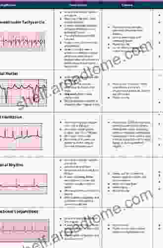 Basic Concepts of EKG A Simplified Approach