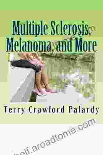 Multiple Sclerosis Melanoma and More (Multiple Sclerosis an Enigma 2)